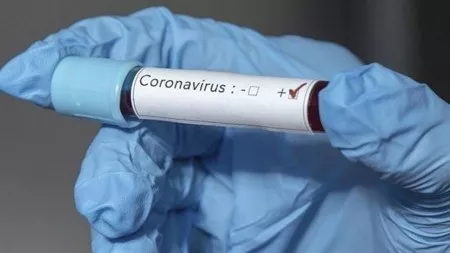 Оперативный штаб обнародовал новую сводку по заболеваемости коронавирусом в Кабардино-Балкарии